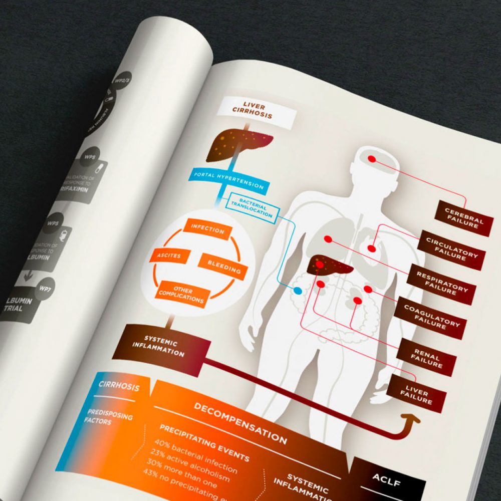 LIVER-FAILURE2 scientific infographics